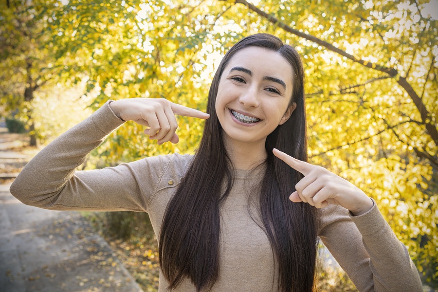 Braces in One Day: Transform Your Smile Faster Than You Think!