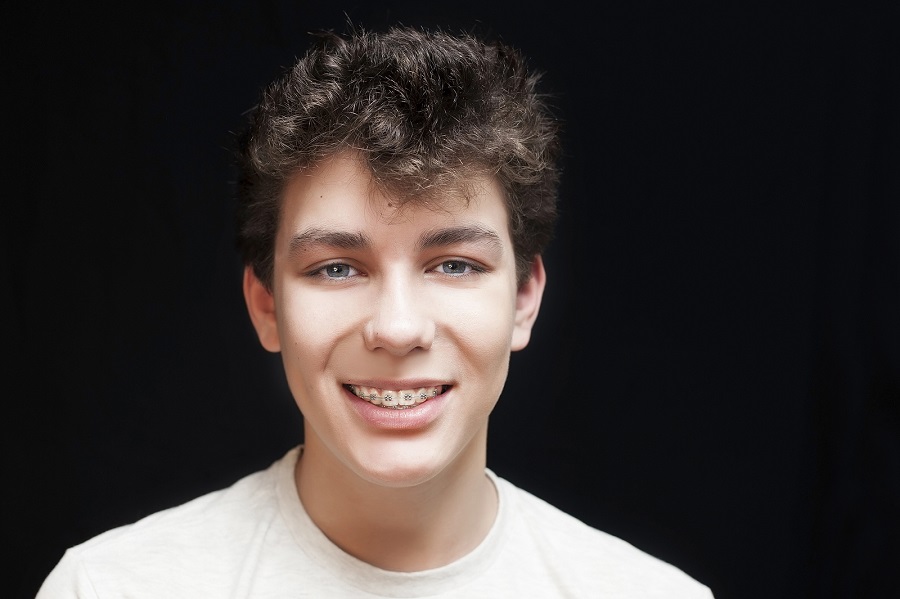 At what Age are you too Old to Start Braces?