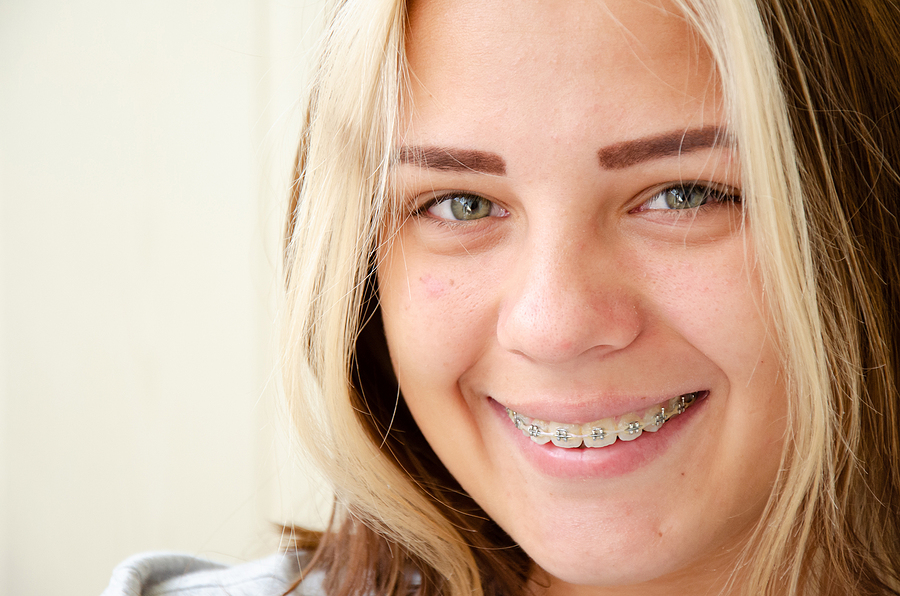 Commonly Asked Questions About Orthodontic Treatments