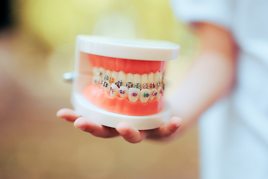 Braces-Friendly Foods and Snacks you can Enjoy this Fall!