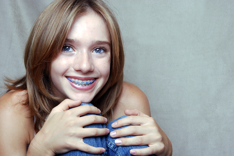 Braces (In One Day) in Bowling Green, Glasgow, and Russellville, KY: A Fast-Track to a Straighter Smile
