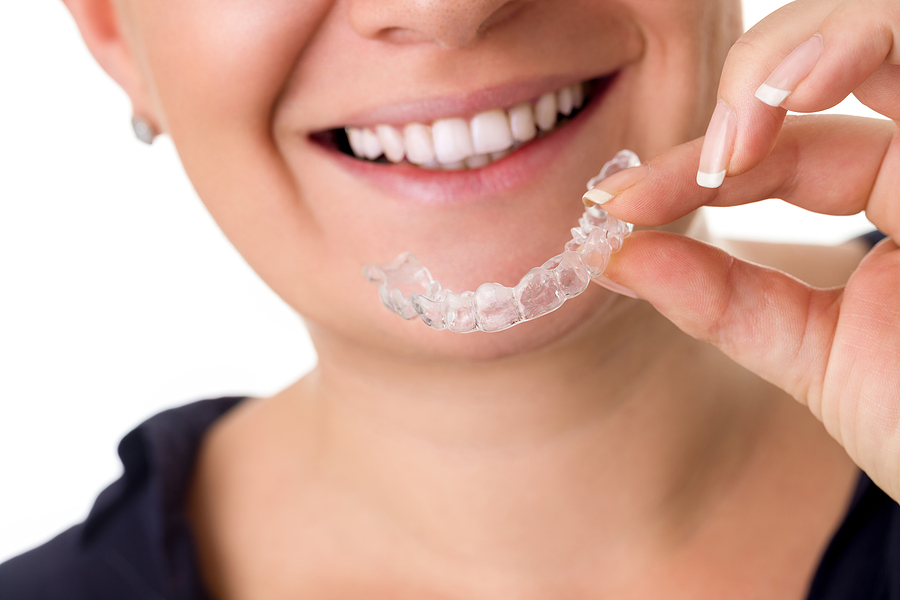 How Long Does Invisalign Treatment Take? Understanding Your Timeline
