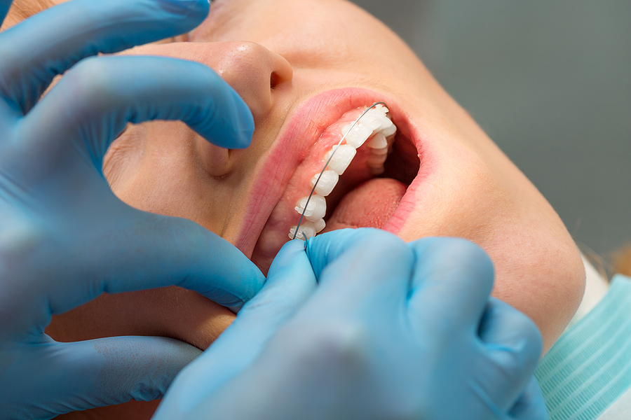 Comprehensive Orthodontic Evaluation in Bowling Green, Glasgow, and Russellville, KY